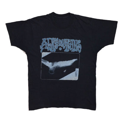 ALICE IN CHAINS BROKEN FOOT X-RAY